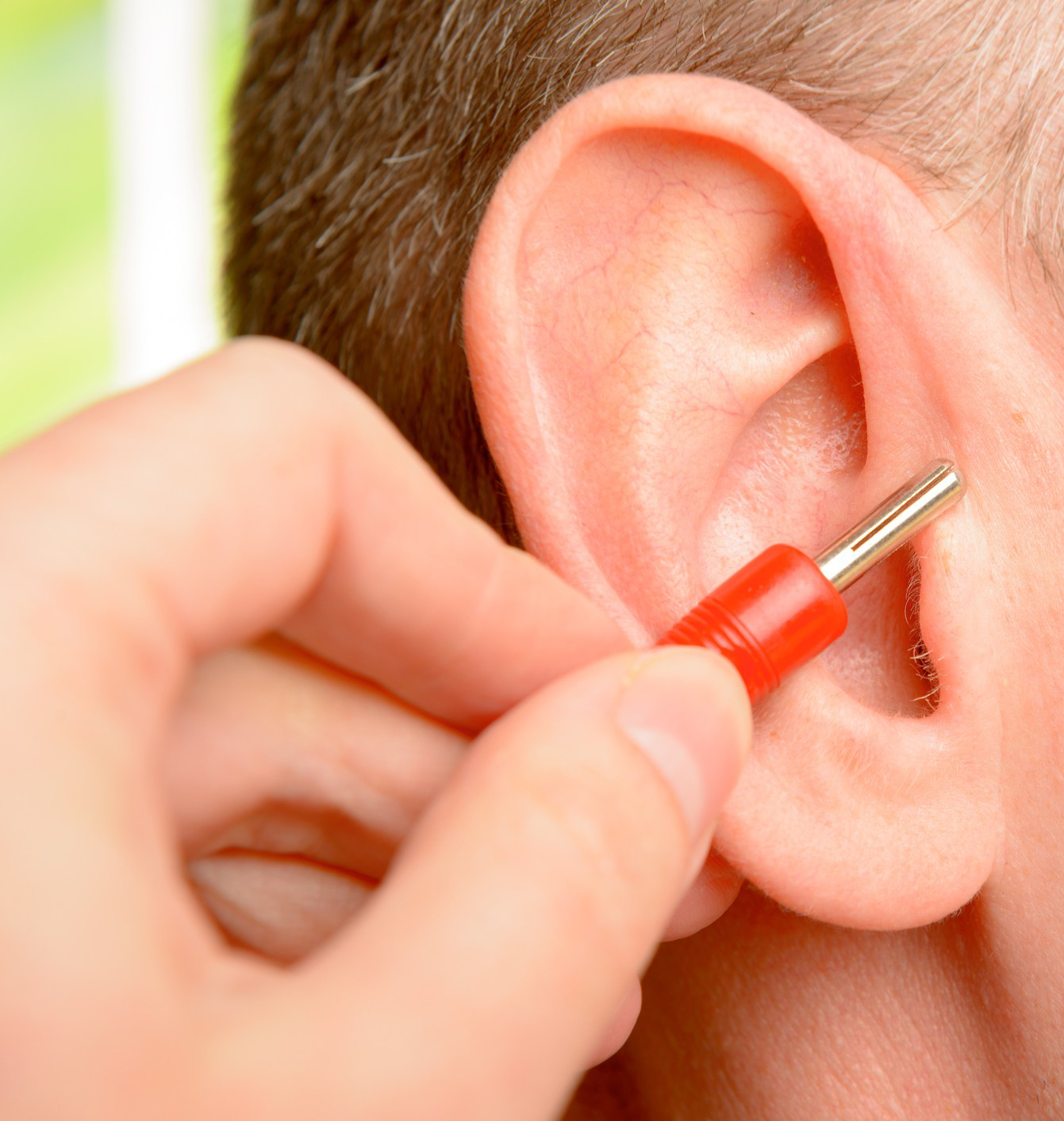 Close up image of acupuncturist holding Auriculotherapy device and a man's ear, providing acupuncture on the ears in Edmonton Alberta for smoking cessation